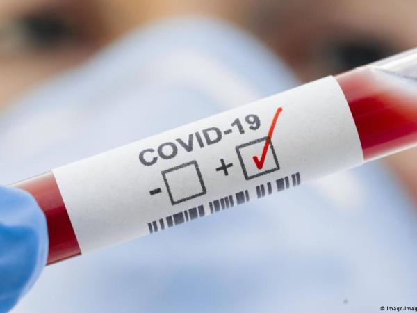 Новина Епідемічна ситуація з коронавірусної хвороби COVID-19 Ранкове місто. Кропивницький