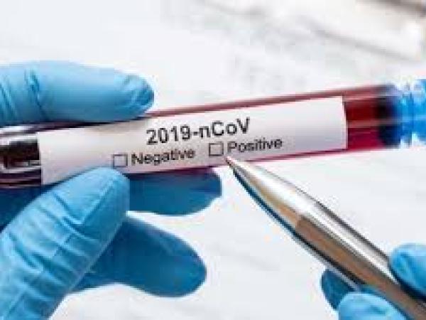 Новина У Кропивницькому районі зареєстровано 26 випадків коронавірусу Ранкове місто. Кропивницький
