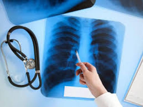 Новина На Кіровоградщині спостерігається зменшення рівня захворюваності на туберкульоз Ранкове місто. Кропивницький
