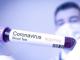 Перша українка в Італії заразилася коронавірусом