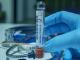 На Кіровоградщині виявили п’ятнадцять осіб, заражених коронавірусом