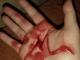 Кіровоградщина: В Олександрії жінка вбила співмешканця пляшкою з-під горілки