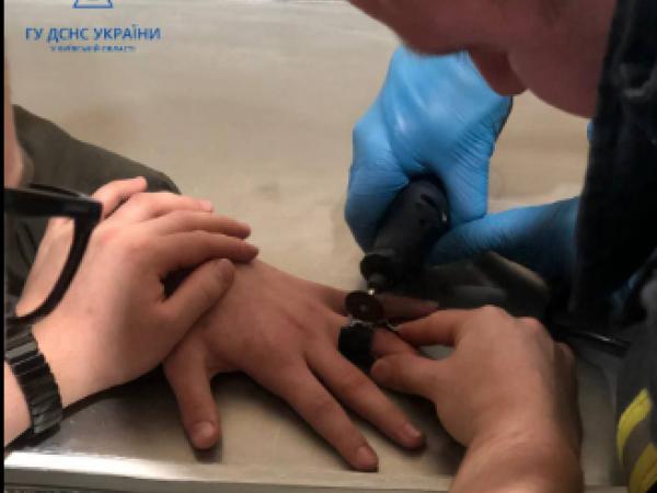 Новина Рятувальникам довелося знімати кільце з пальца 12-річного підлітка, бо медики не впоралися Ранкове місто. Кропивницький