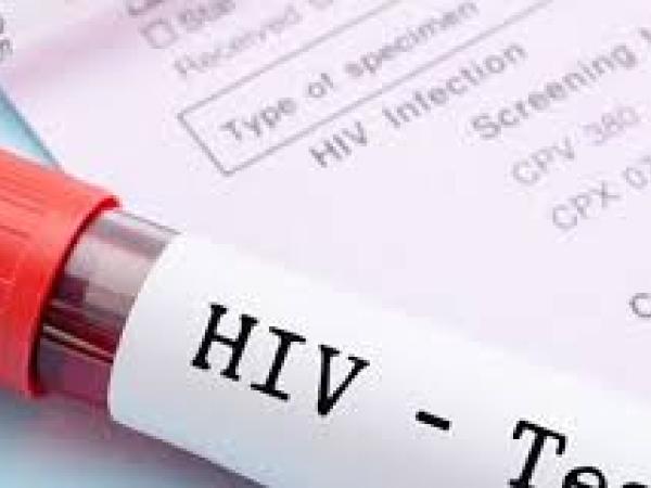 Новина Кропивничани зможуть безкоштовно пройти тест на ВІЛ Ранкове місто. Кропивницький