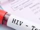 Кропивничани зможуть безкоштовно пройти тест на ВІЛ