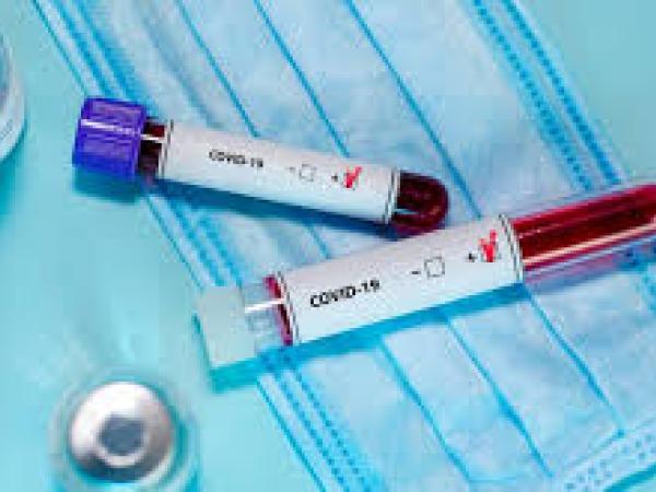 Новина Четверо випадків коронавірусу зафіксували у Кропивницькому районі Ранкове місто. Кропивницький